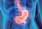 Gastrite: especialista dá dicas para prevenir e tratar a doença