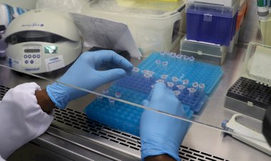 Panorama epidemiológico da Covid-19 no Amazonas é divulgado pela FVS-RCP, nesta segunda-feira (18/10)