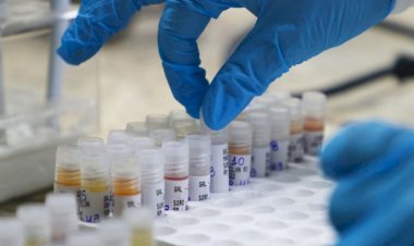 Mpox: Informe semanal atualiza cenário da doença no Amazonas, nesta terça-feira