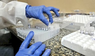 FVS-RCP atualiza informe epidemiológico de Vírus Respiratórios no Amazonas