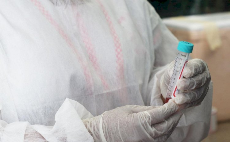 Amazonas não registra óbito por Covid-19 pela sexta vez em dezembro